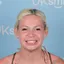 Amy Chesters, UK Smiles patient, after treatment in Antalya