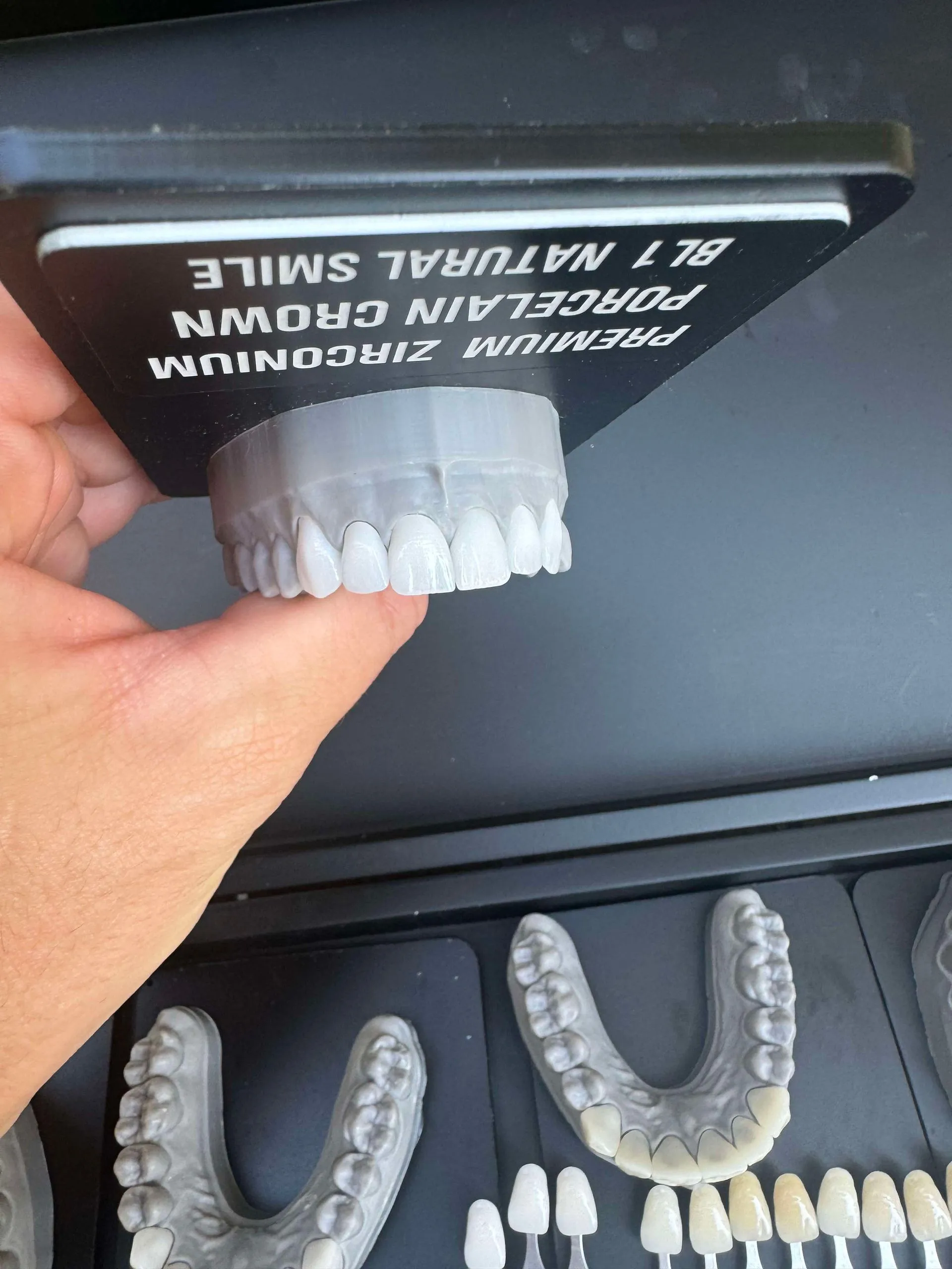 Hand holding a model of upper teeth in a bright shade
