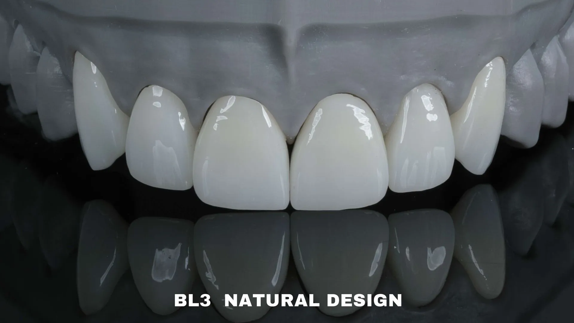 Dental model of BL3 veneers in the natural design with rounded edges