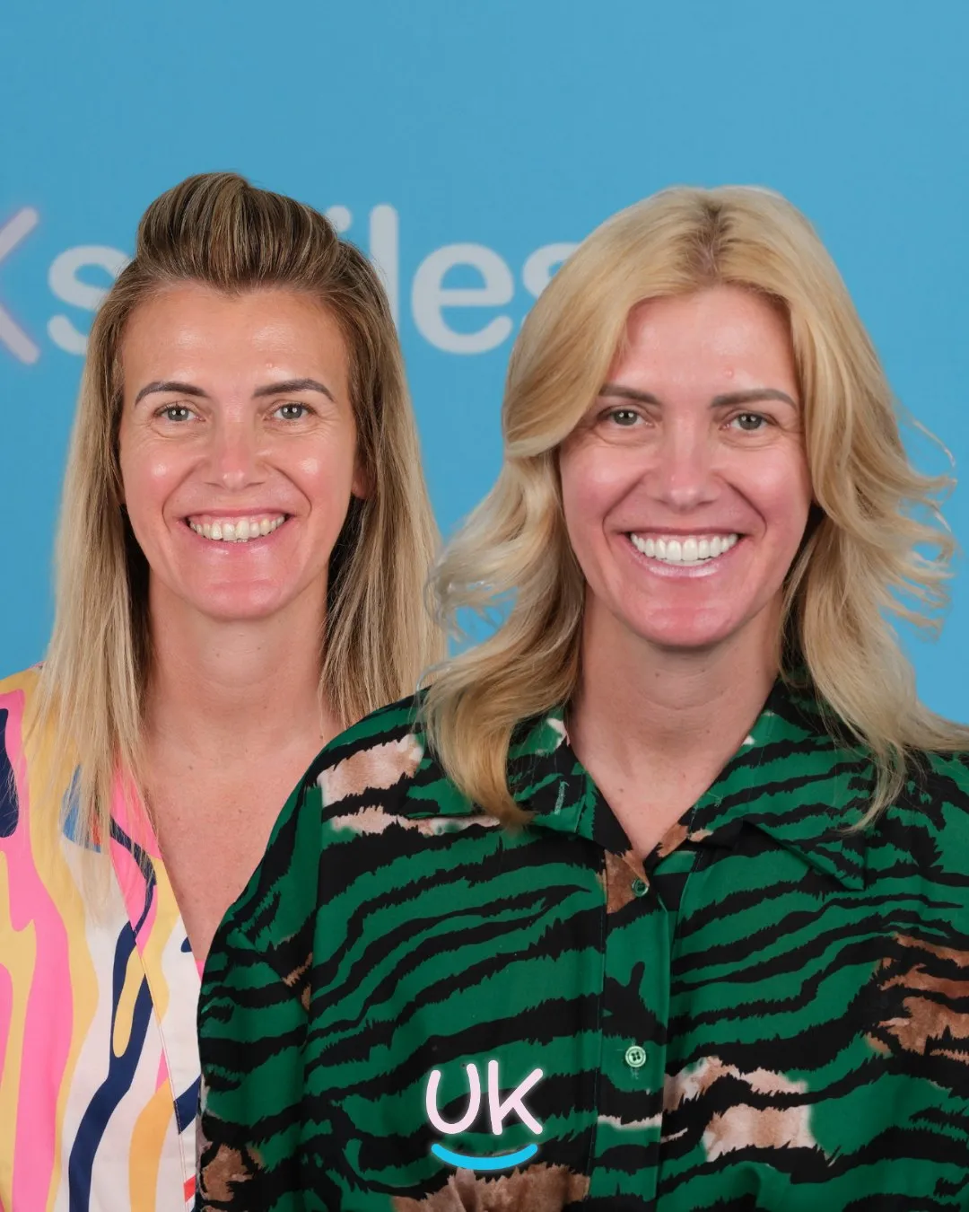 Blonde woman in a green patterned shirt before and after her new smile