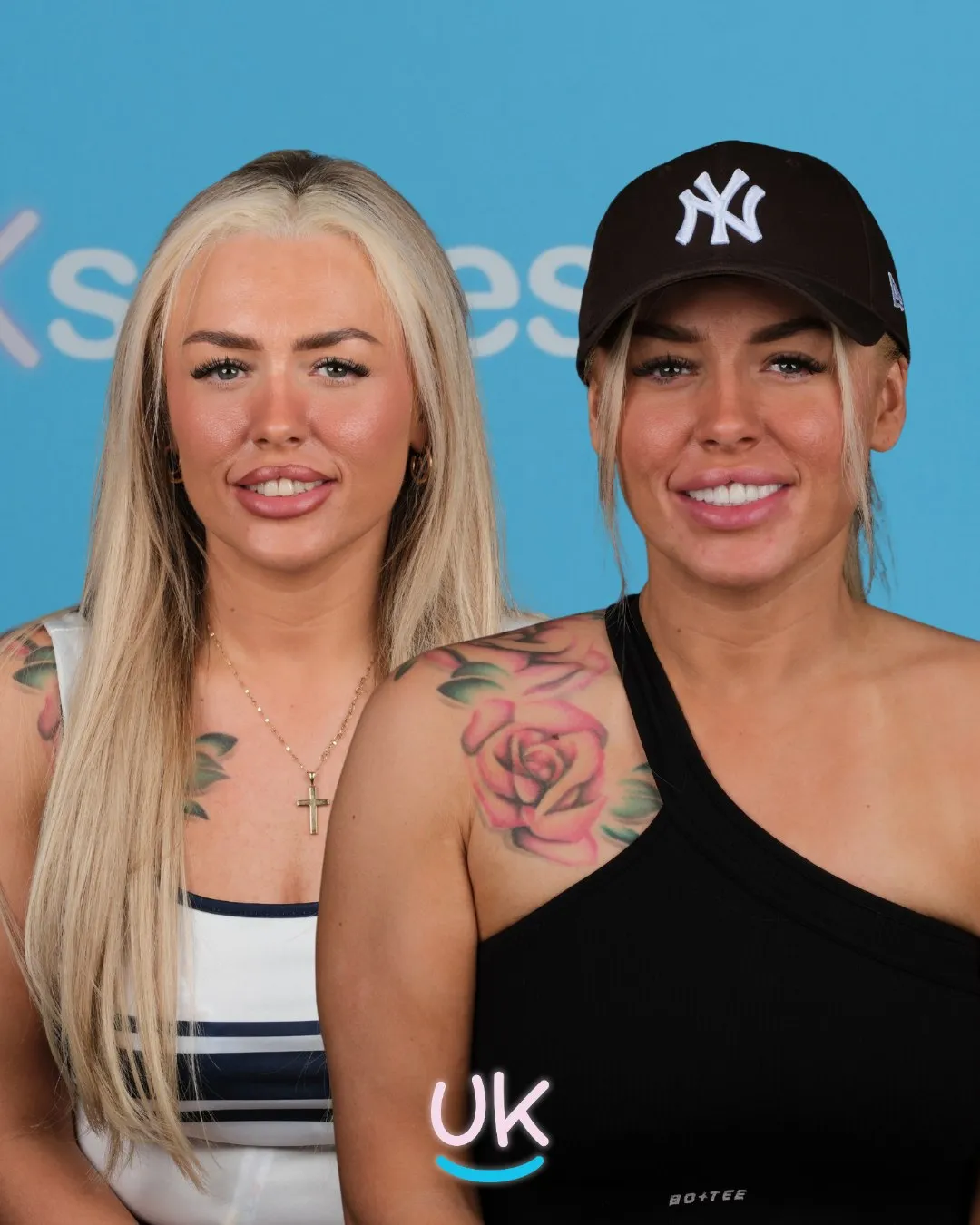 Blonde woman in a New York cap before and after her new teeth