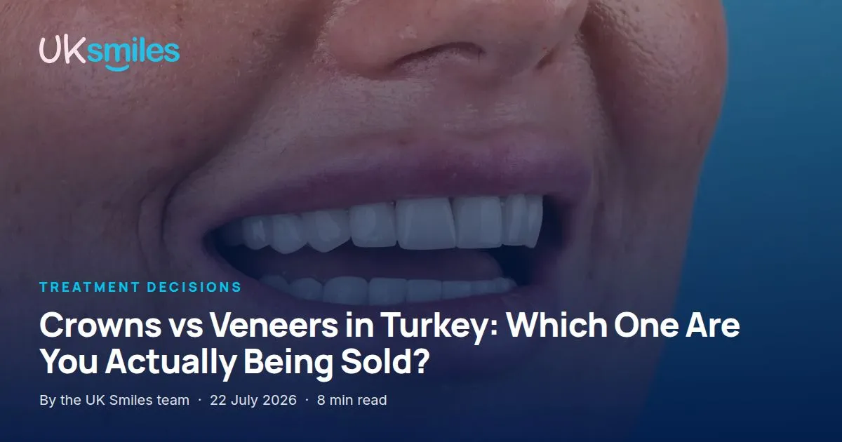 Crowns vs veneers in Turkey: article banner with the guide title over an E-max crown case at UK Smiles