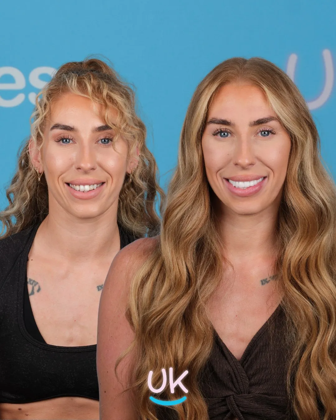 Woman with long curly hair before and after her new smile at UK Smiles