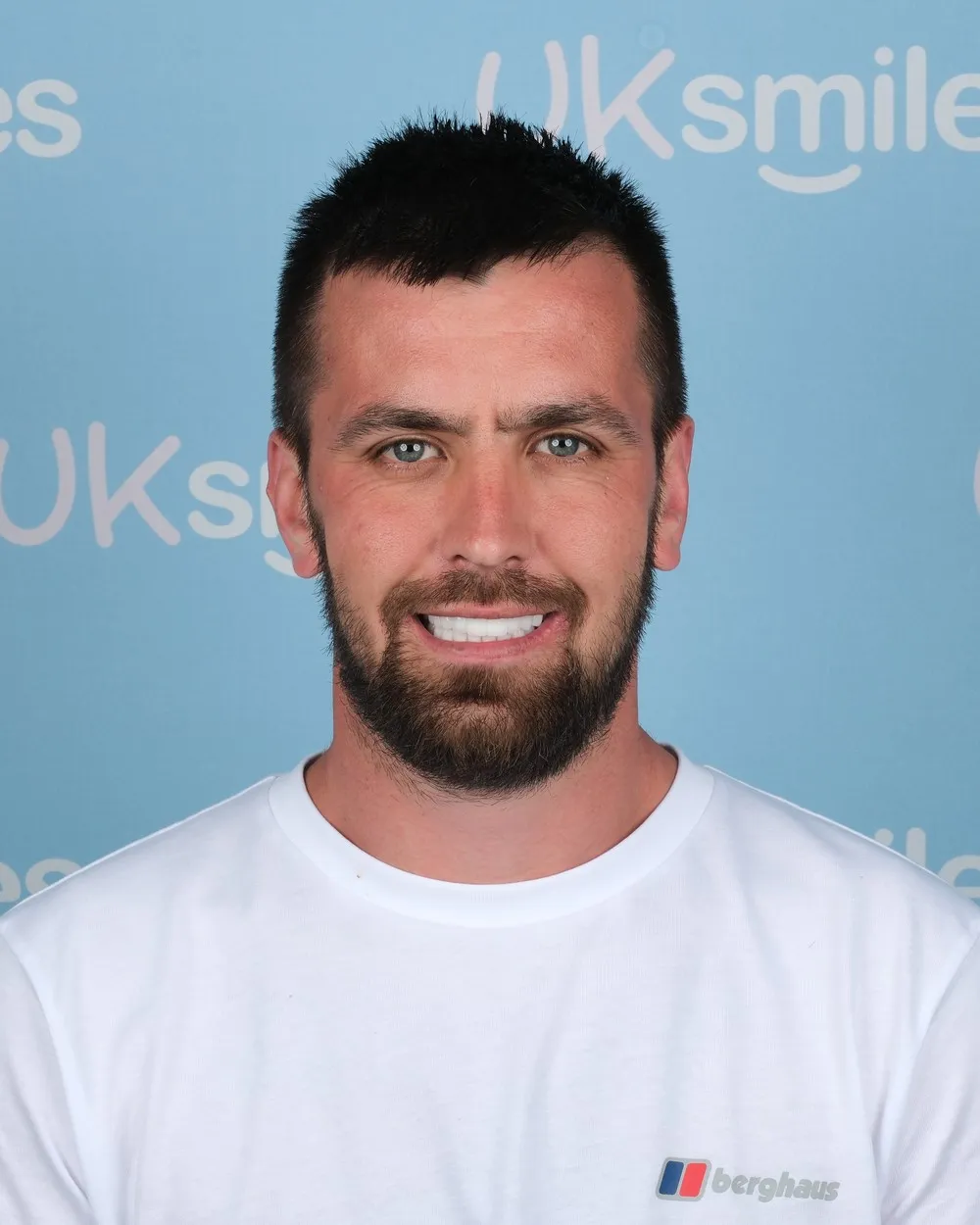 Jack after Dental Implants and Zirconia Crowns with UK Smiles in Antalya