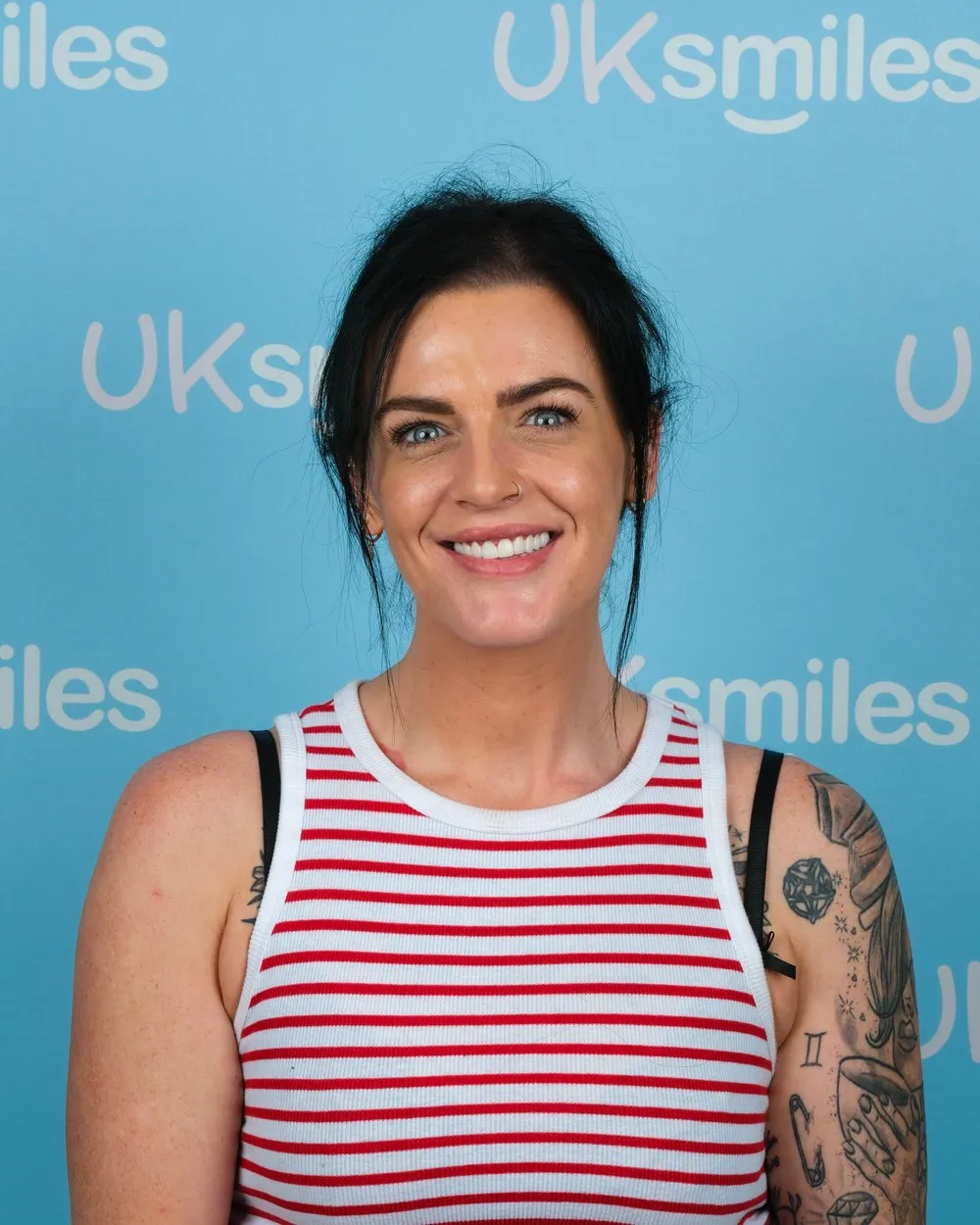 Jodie after Zirconia Crowns with UK Smiles in Antalya