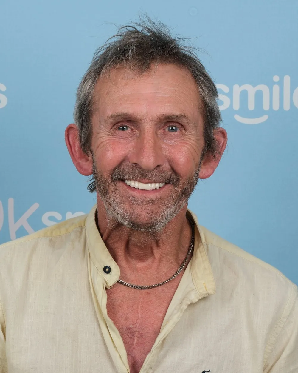 John after Zirconia Crowns with UK Smiles in Antalya