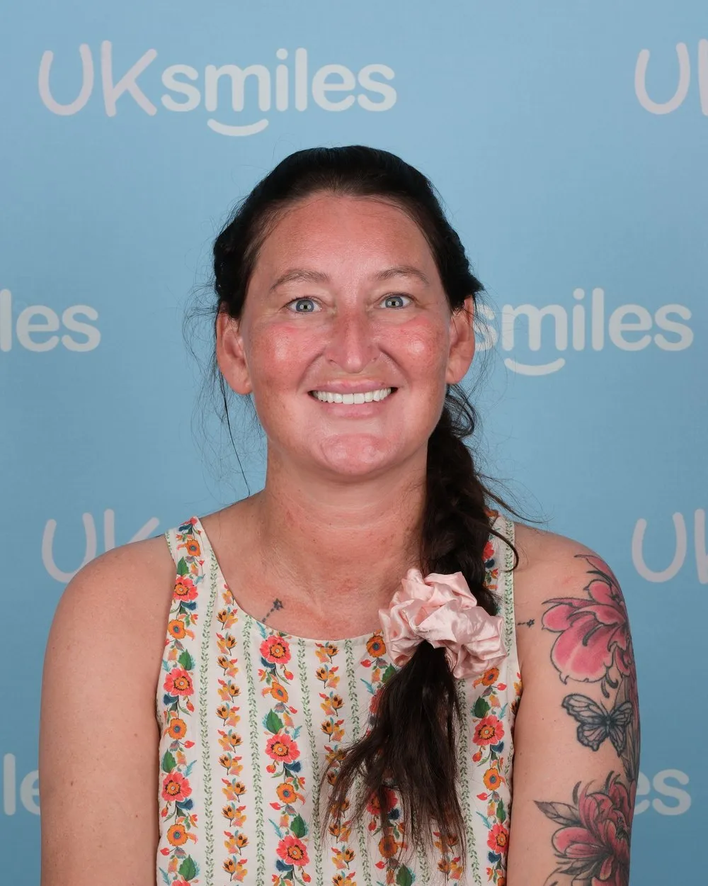 Laura after Emax Crowns with UK Smiles in Antalya