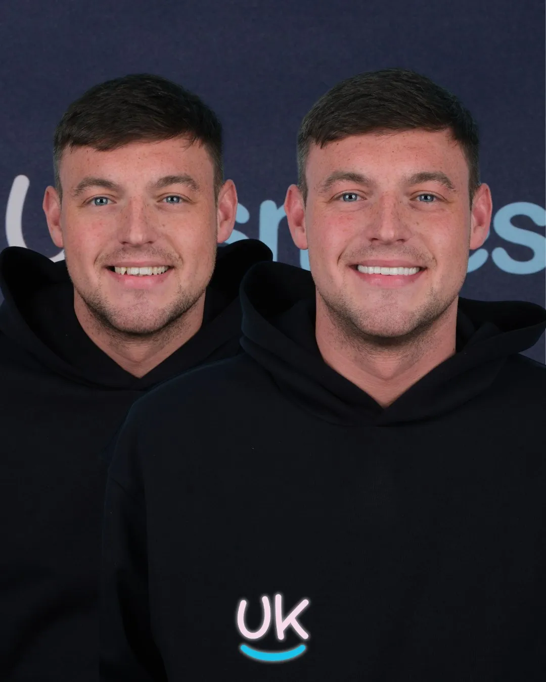 Man in a dark hoodie before and after his new teeth at UK Smiles