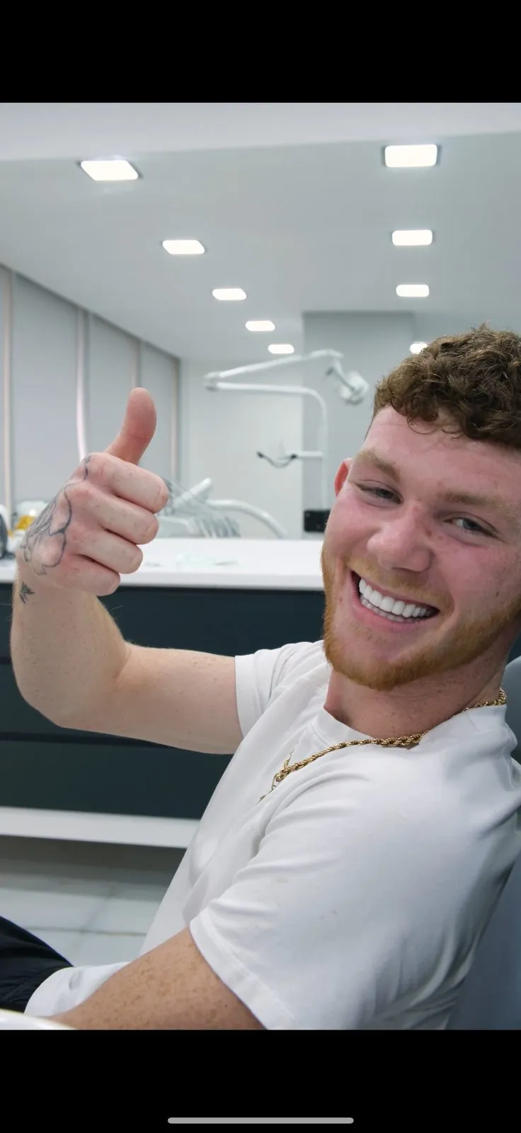 Man in the dental chair giving a thumbs up after treatment in Antalya