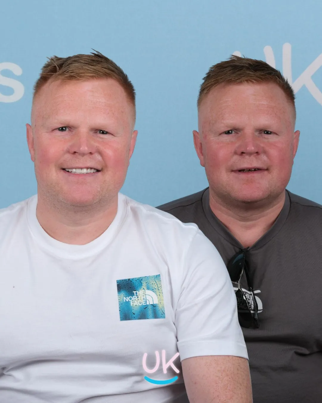 Man in a white T-shirt before and after his new teeth in Antalya