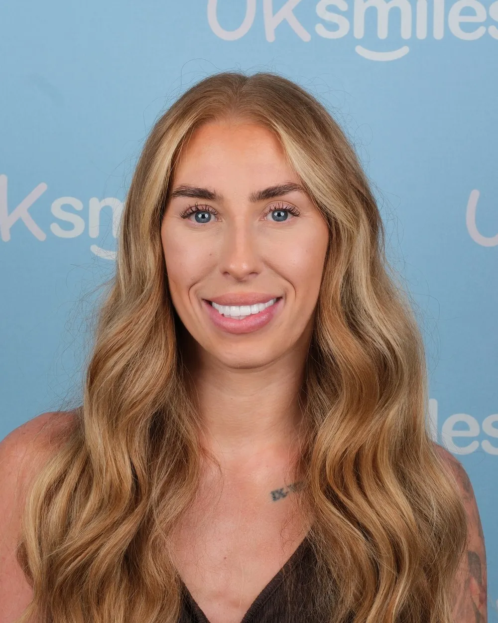 Naomi after Zirconium Crowns with UK Smiles in Antalya