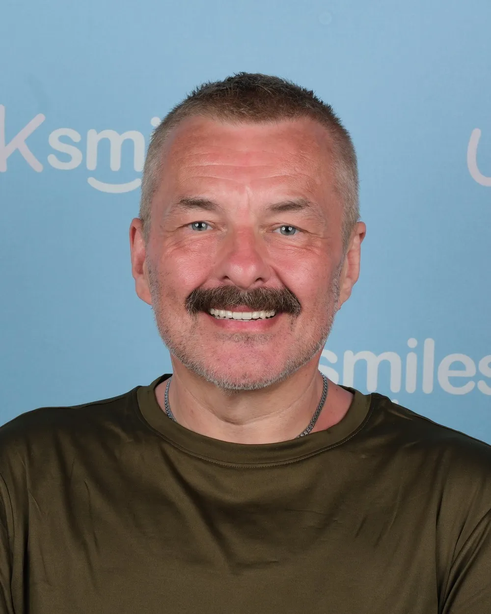Nick after All-on-6 with UK Smiles in Antalya