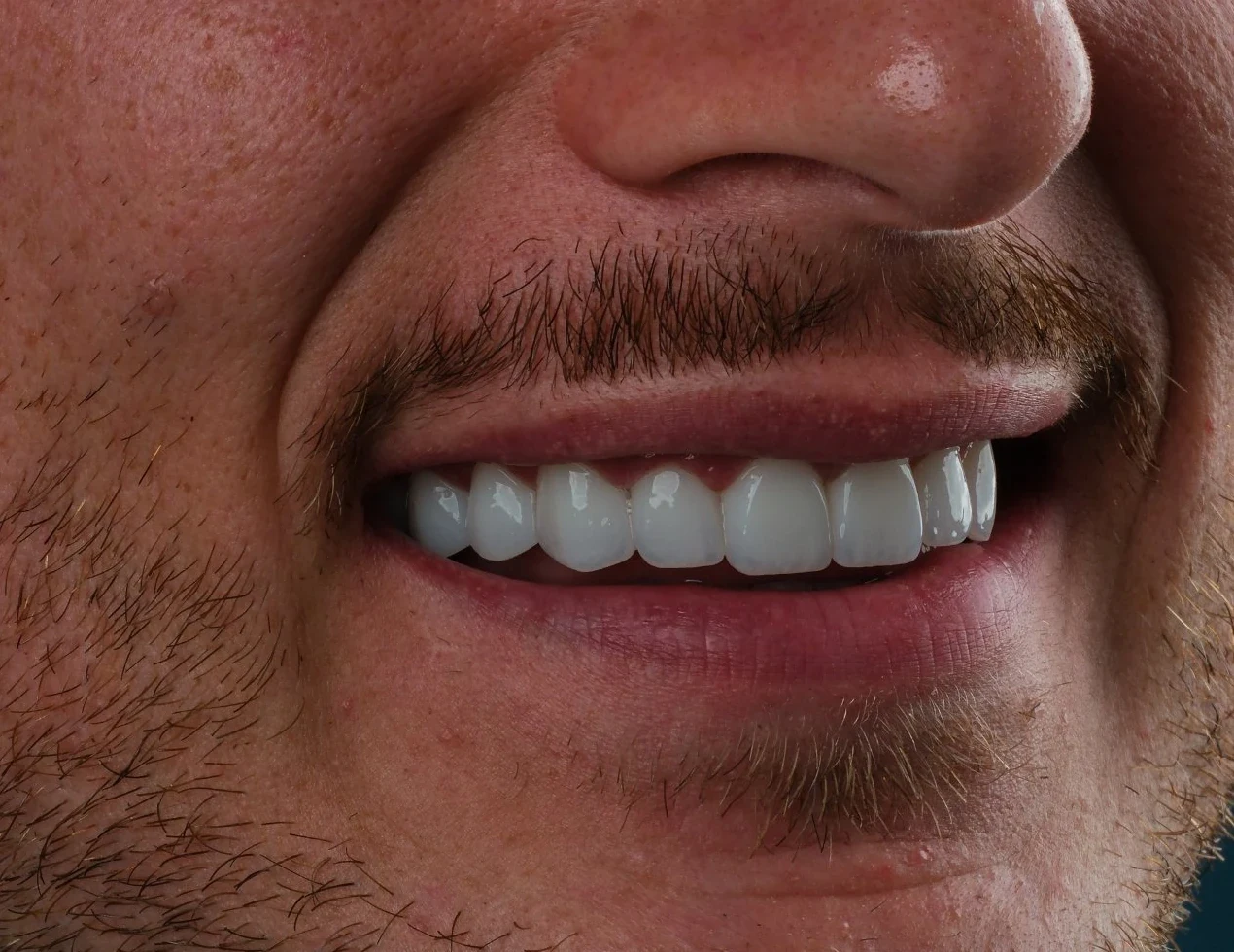Close-up of our founder Sam's smile