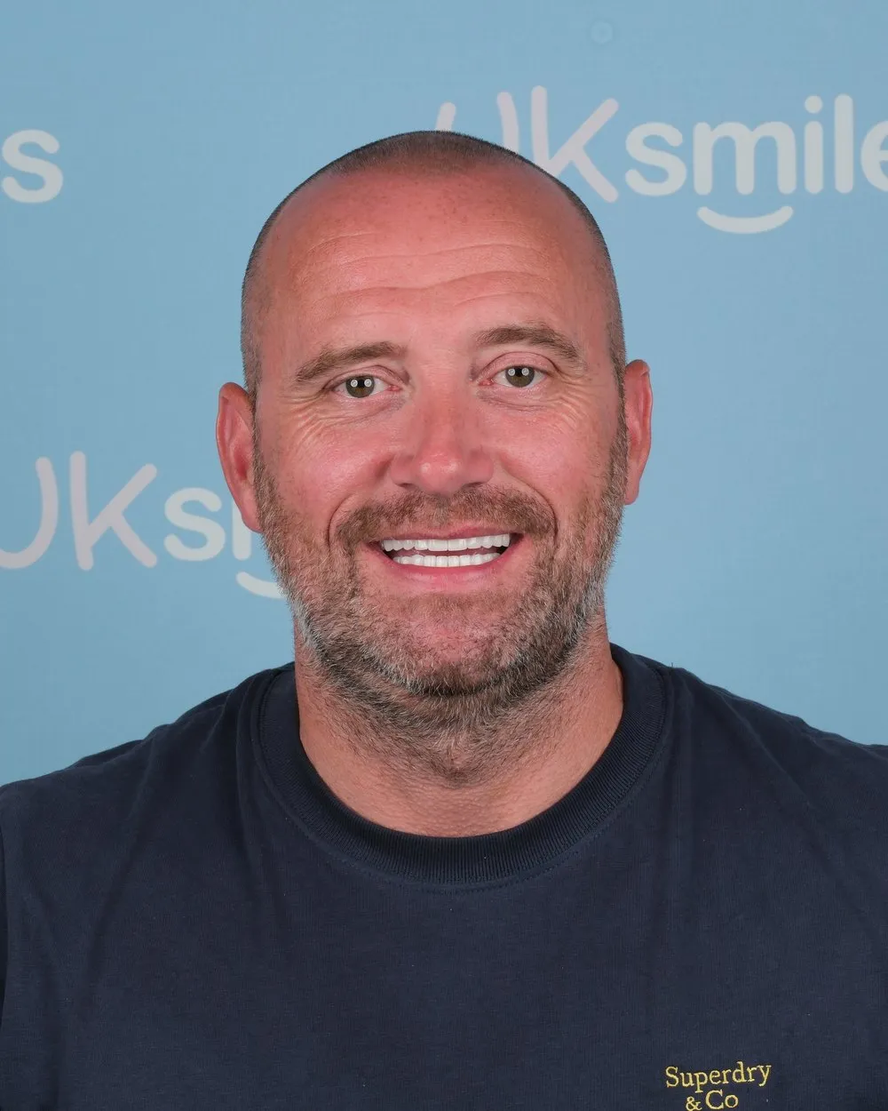 Scott after Implants and Crowns with UK Smiles in Antalya