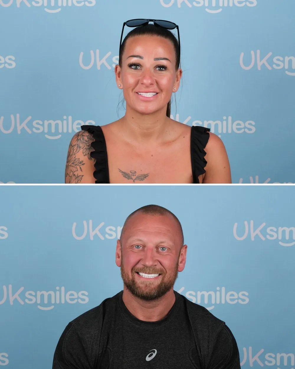 Sian and Christopher after Zirconia Crowns with UK Smiles in Antalya