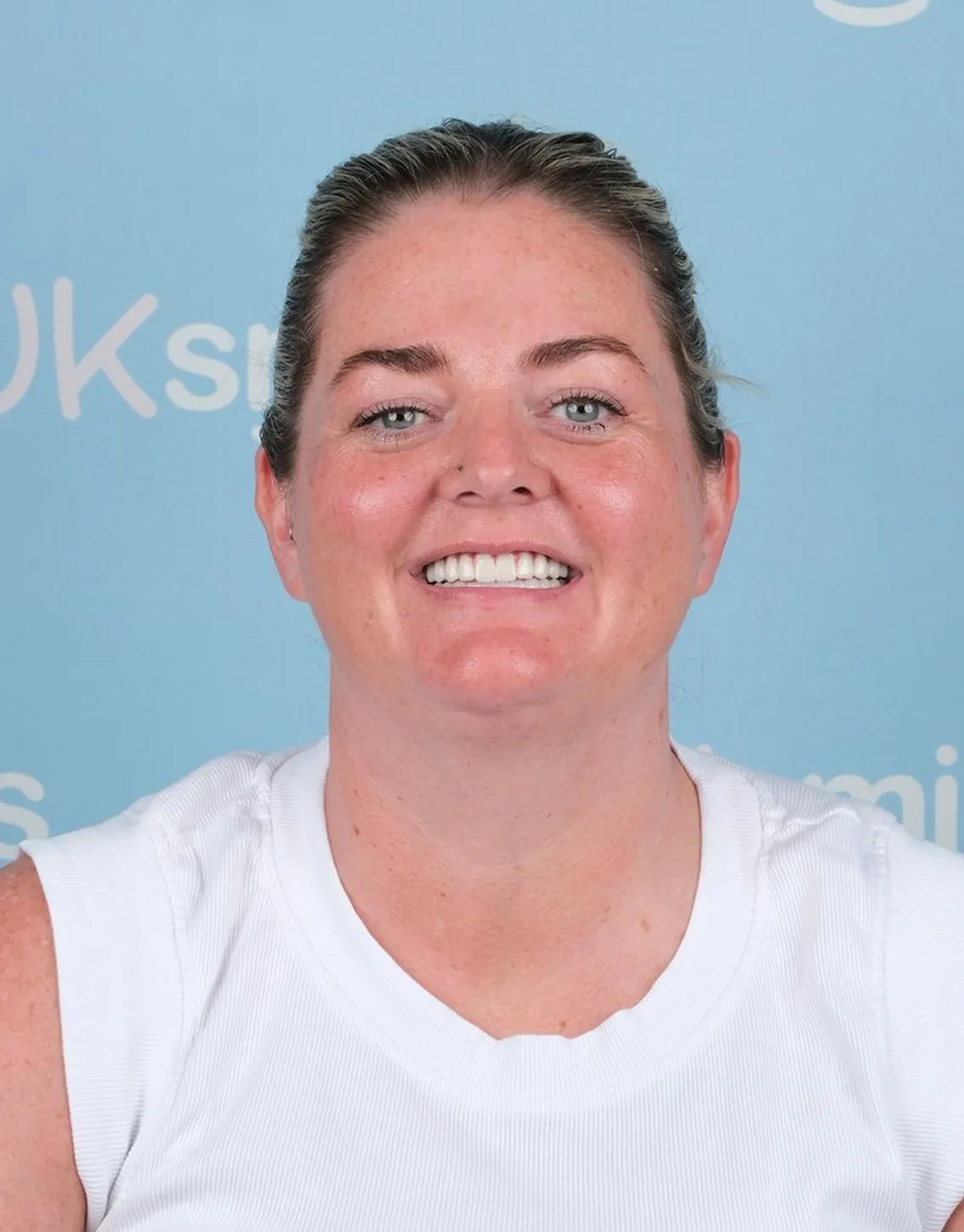Annette, All-on-6 patient at UK Smiles in Antalya