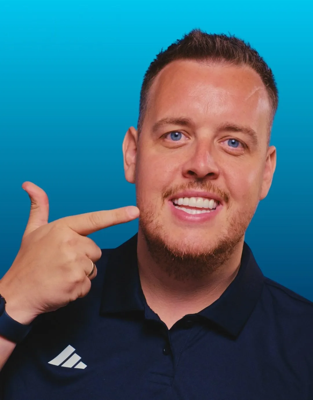 Daniel, UK Smiles patient, smiling after Zirconia Crowns