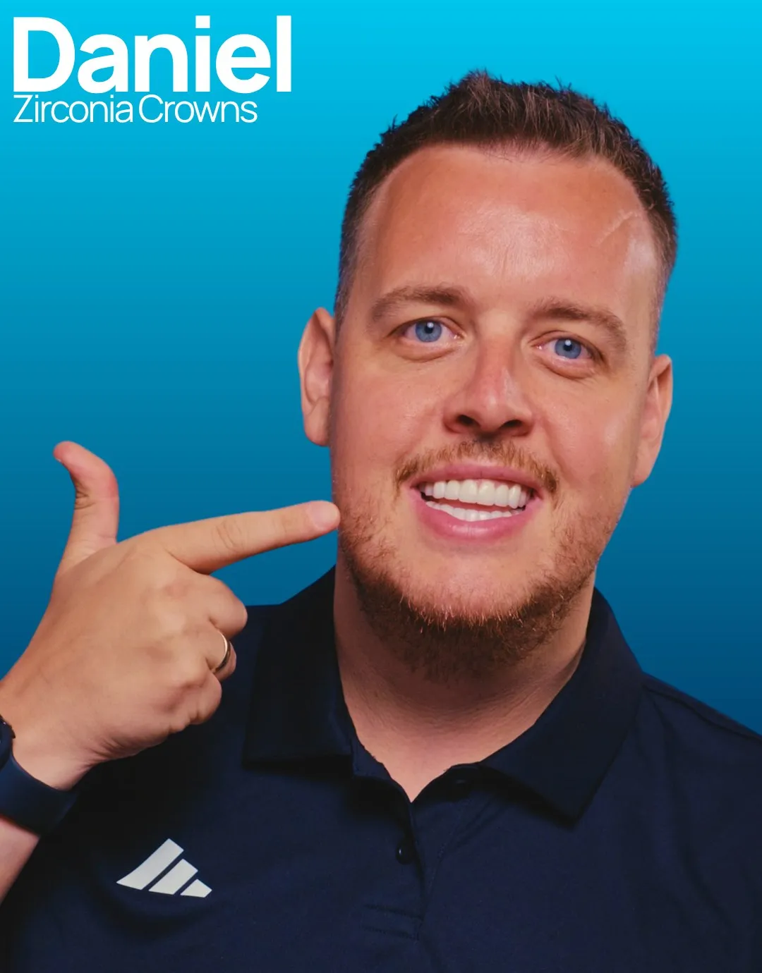 Daniel, Zirconium Crowns patient at UK Smiles