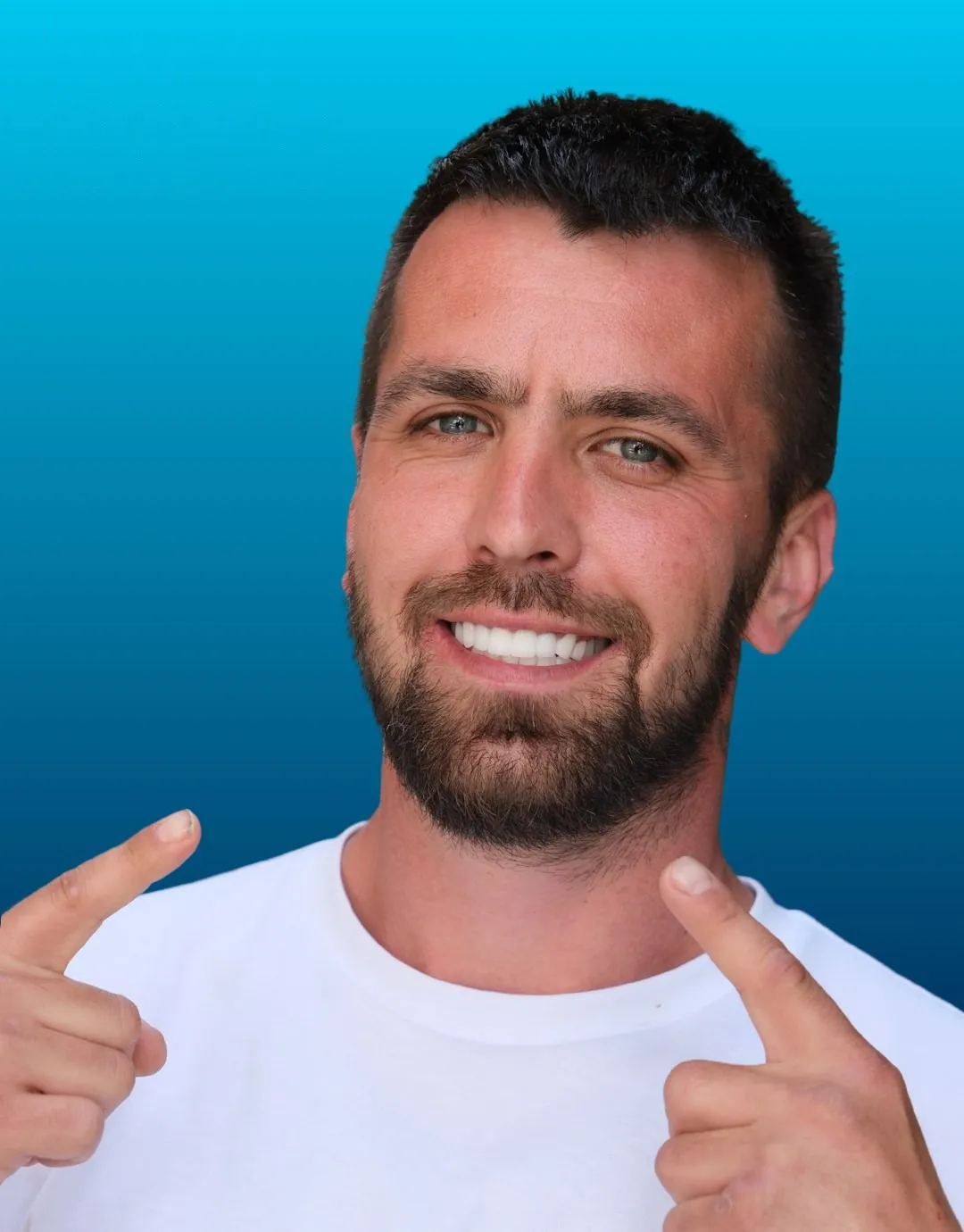 Jack, UK Smiles patient, smiling after Dental Implants