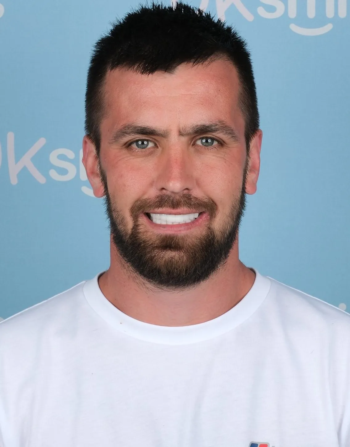 Jack, Dental Implants and Zirconia Crowns patient at UK Smiles in Antalya