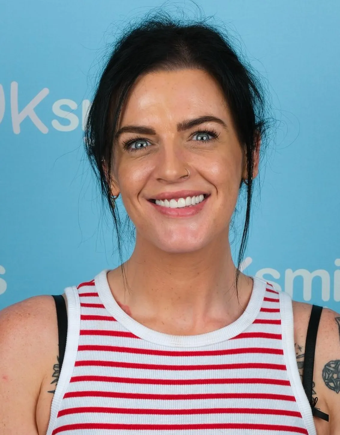 Jodie, Zirconia Crowns patient at UK Smiles in Antalya