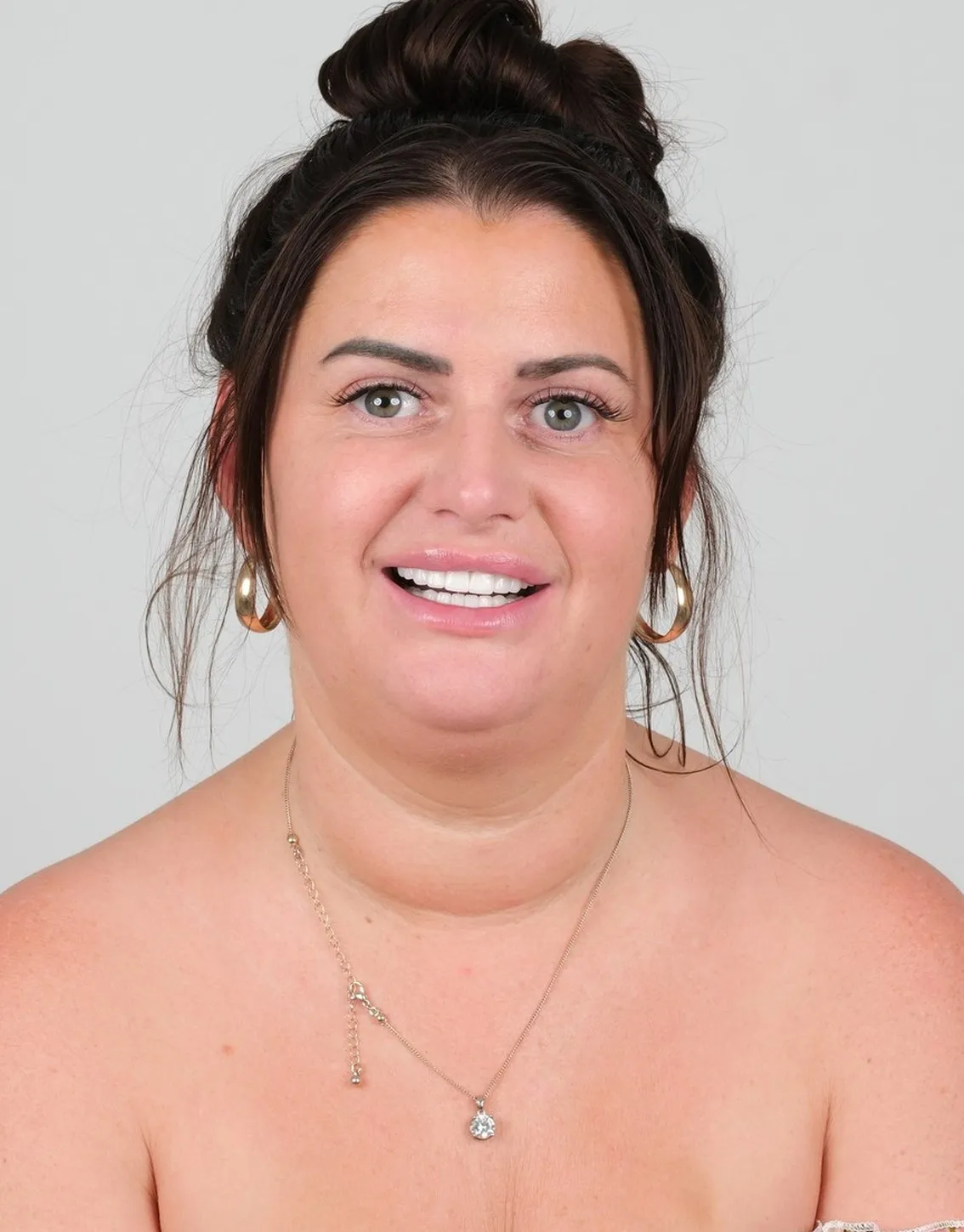 Katie, Zirconia Crowns patient at UK Smiles in Antalya