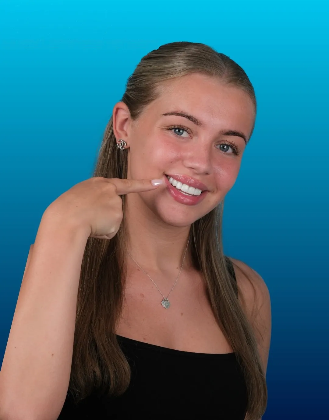 Kelsey, UK Smiles patient, smiling after Emax Veneers