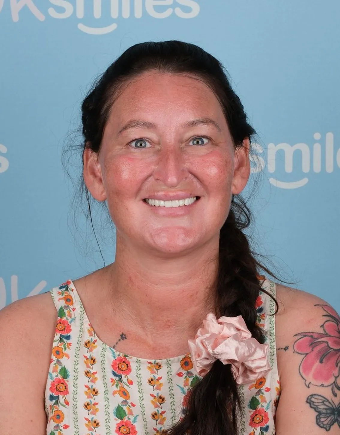 Laura, Emax Crowns patient at UK Smiles in Antalya