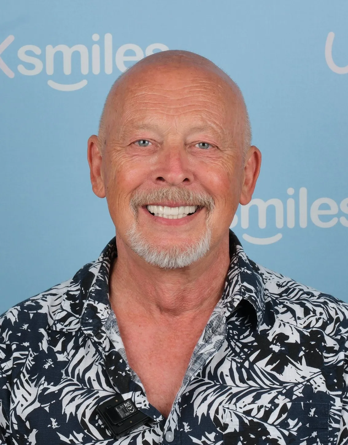 Michael, Implants and Crowns patient at UK Smiles in Antalya
