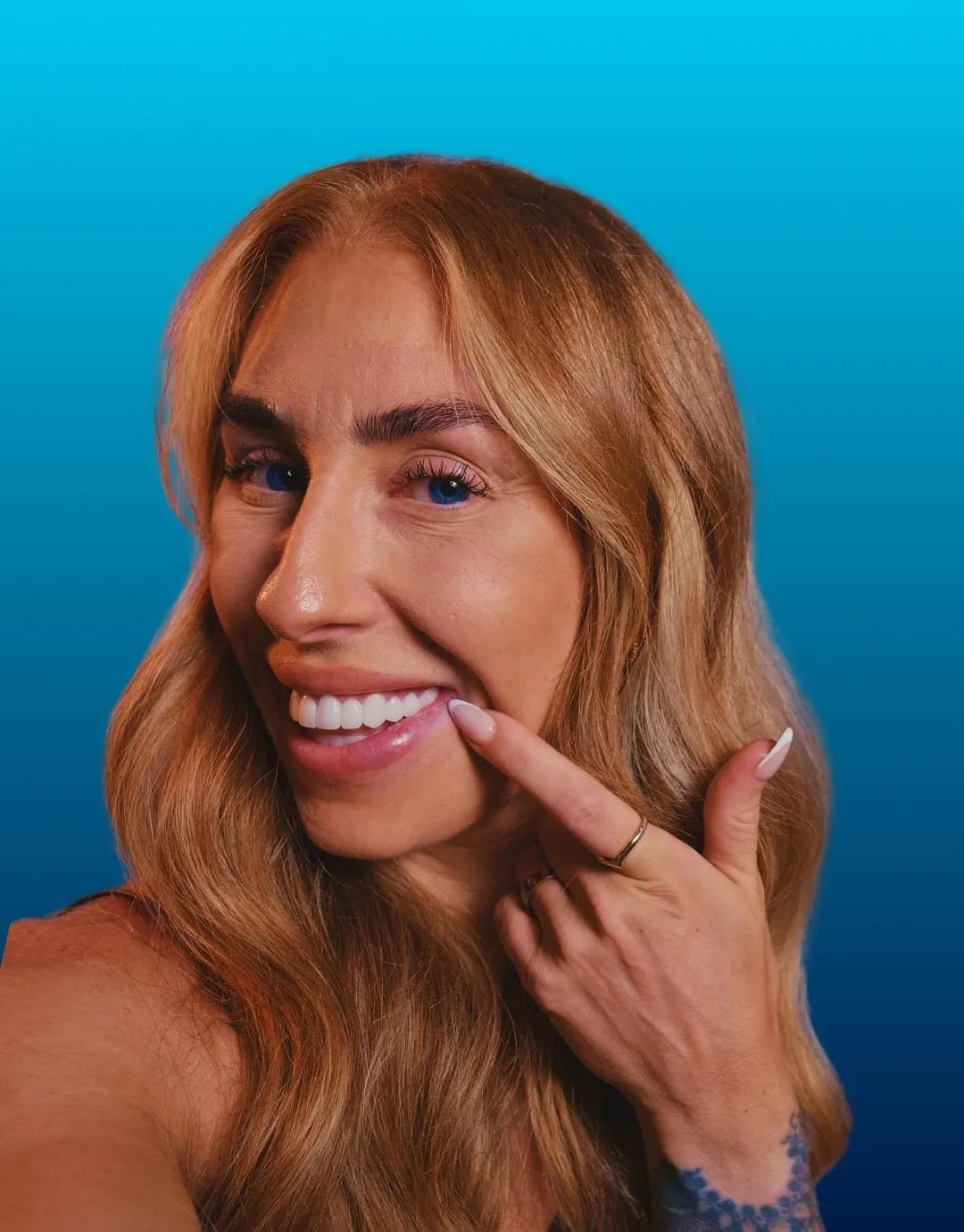 Naomi, UK Smiles patient, smiling after Zirconia Crowns
