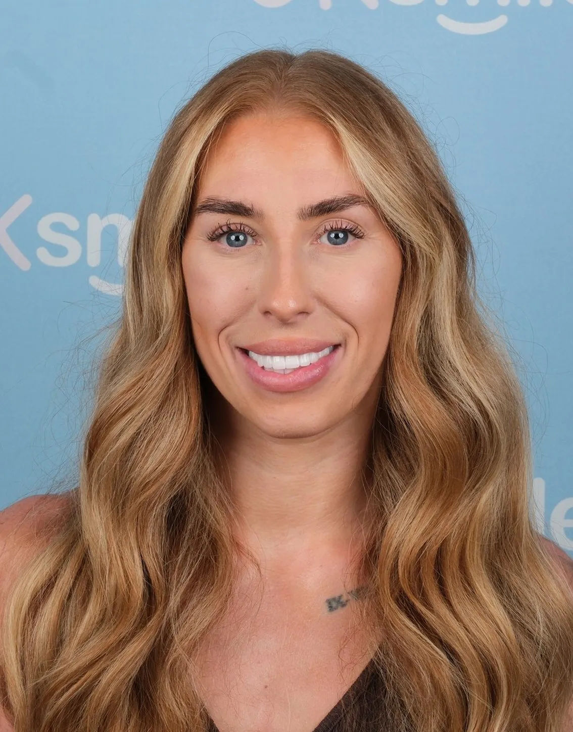 Naomi, Zirconium Crowns patient at UK Smiles in Antalya
