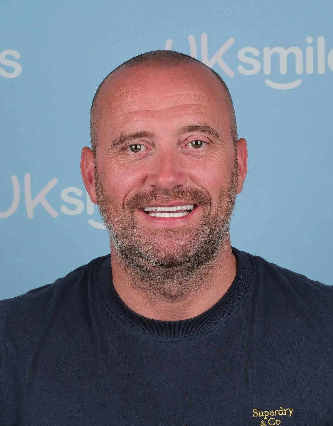 Scott, Implants and Crowns patient at UK Smiles in Antalya