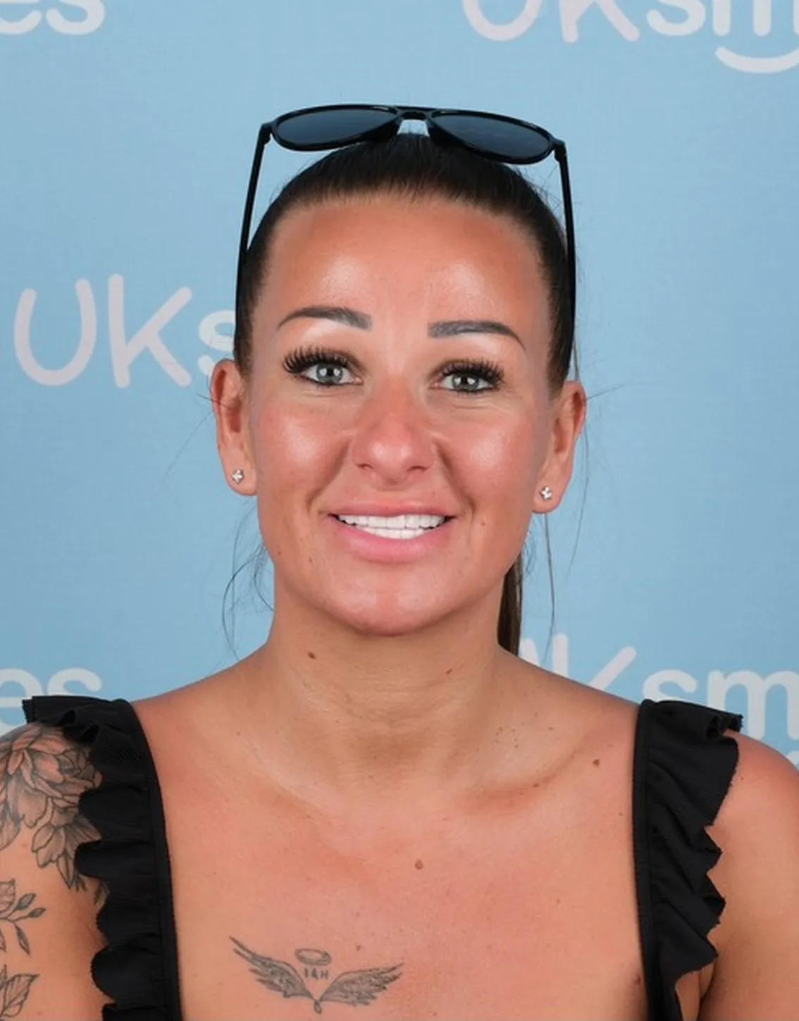 Sian and Christopher, Zirconia Crowns patient at UK Smiles in Antalya