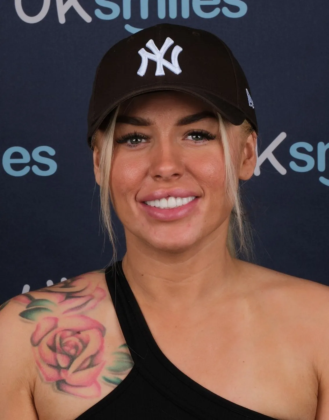 Stacey, Emax Veneers patient at UK Smiles in Antalya