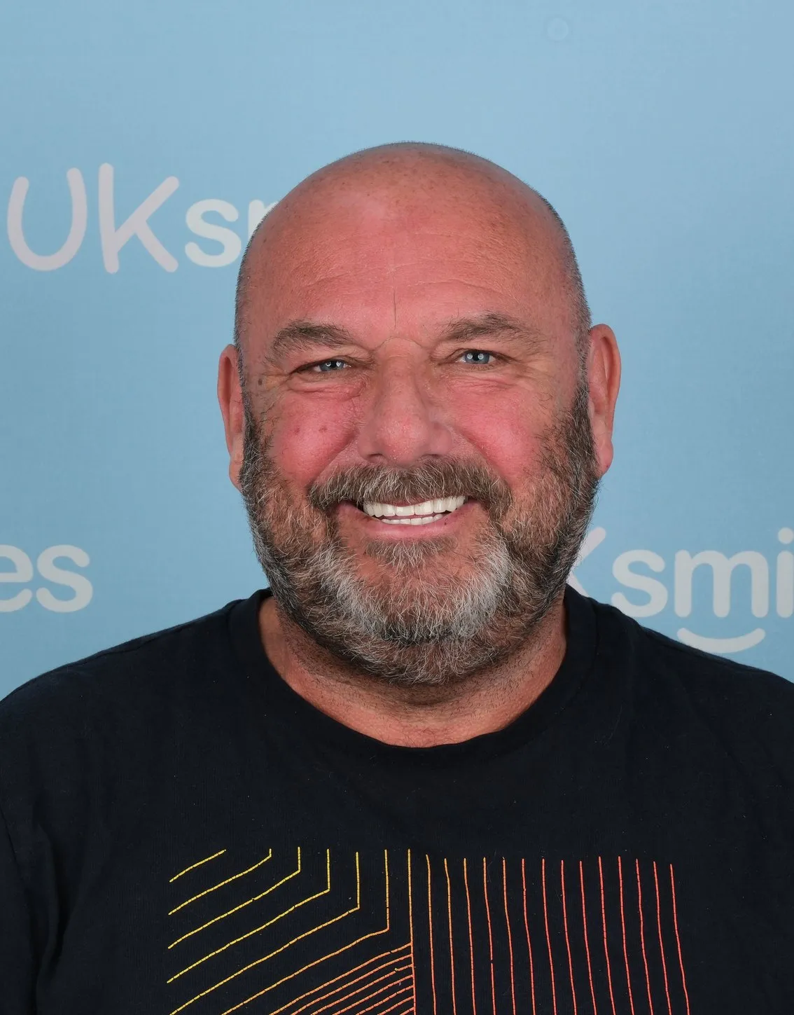 William, Zirconia Crowns patient at UK Smiles in Antalya