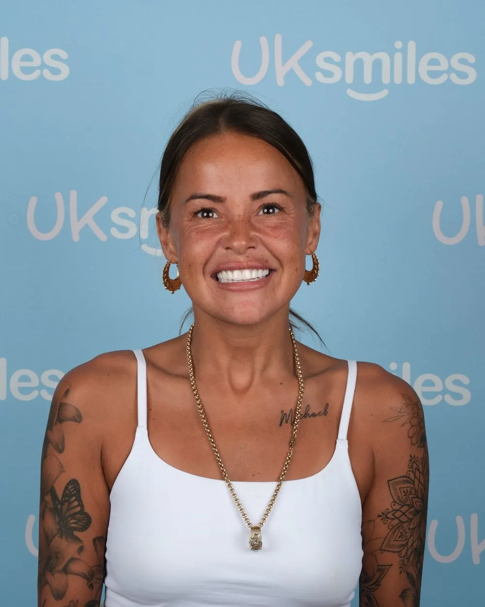 Terri after Zirconia Crowns with UK Smiles in Antalya