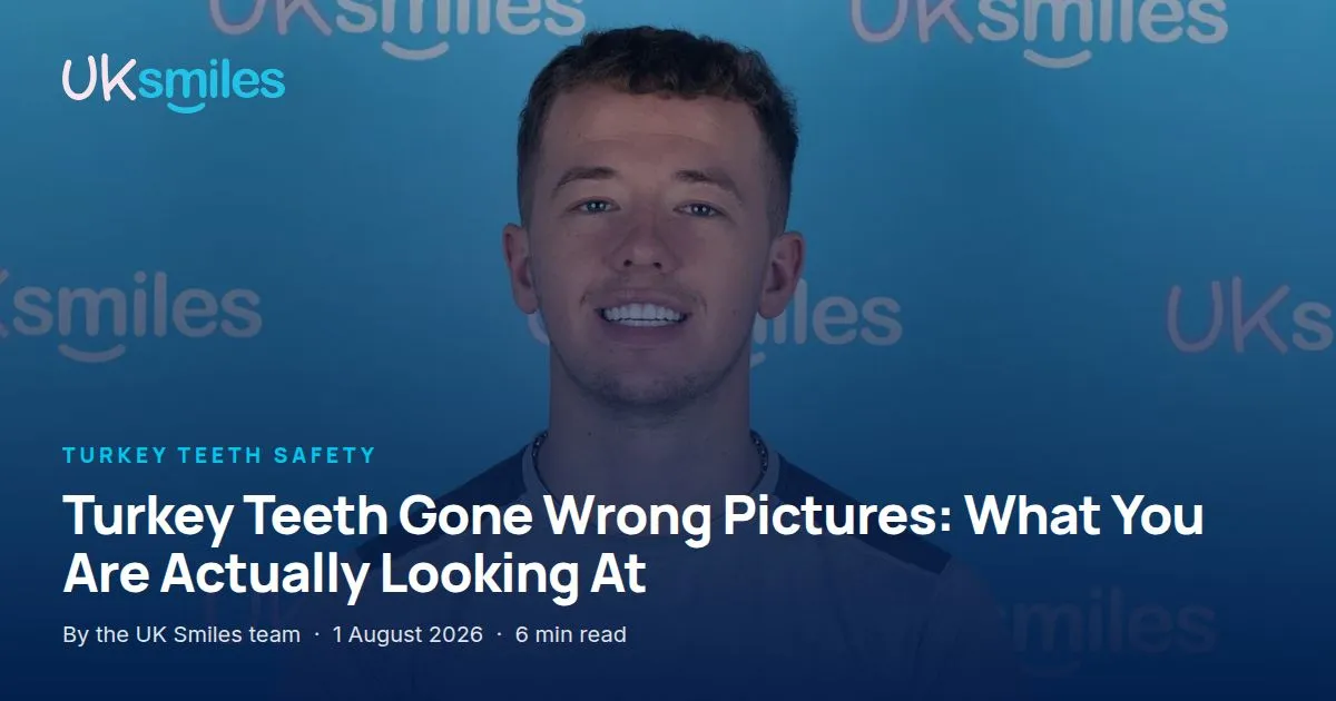 Turkey teeth gone wrong pictures: article banner with the guide title over the UK Smiles treatment room in Antalya