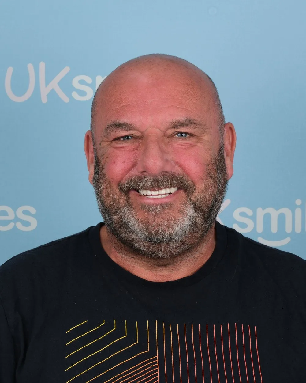 William after Zirconia Crowns with UK Smiles in Antalya