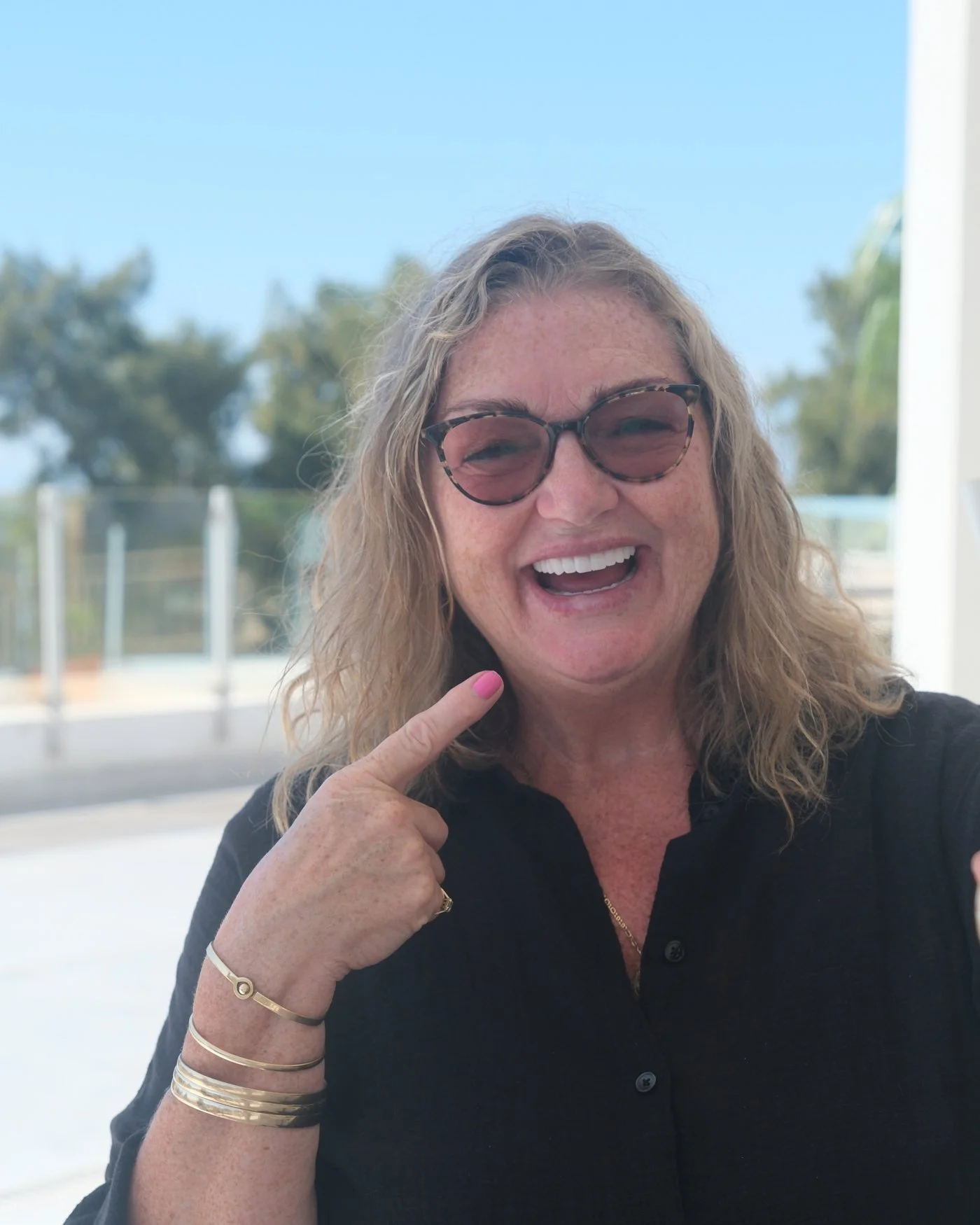 A UK Smiles patient pointing to her new teeth on a sunny hotel terrace in Antalya