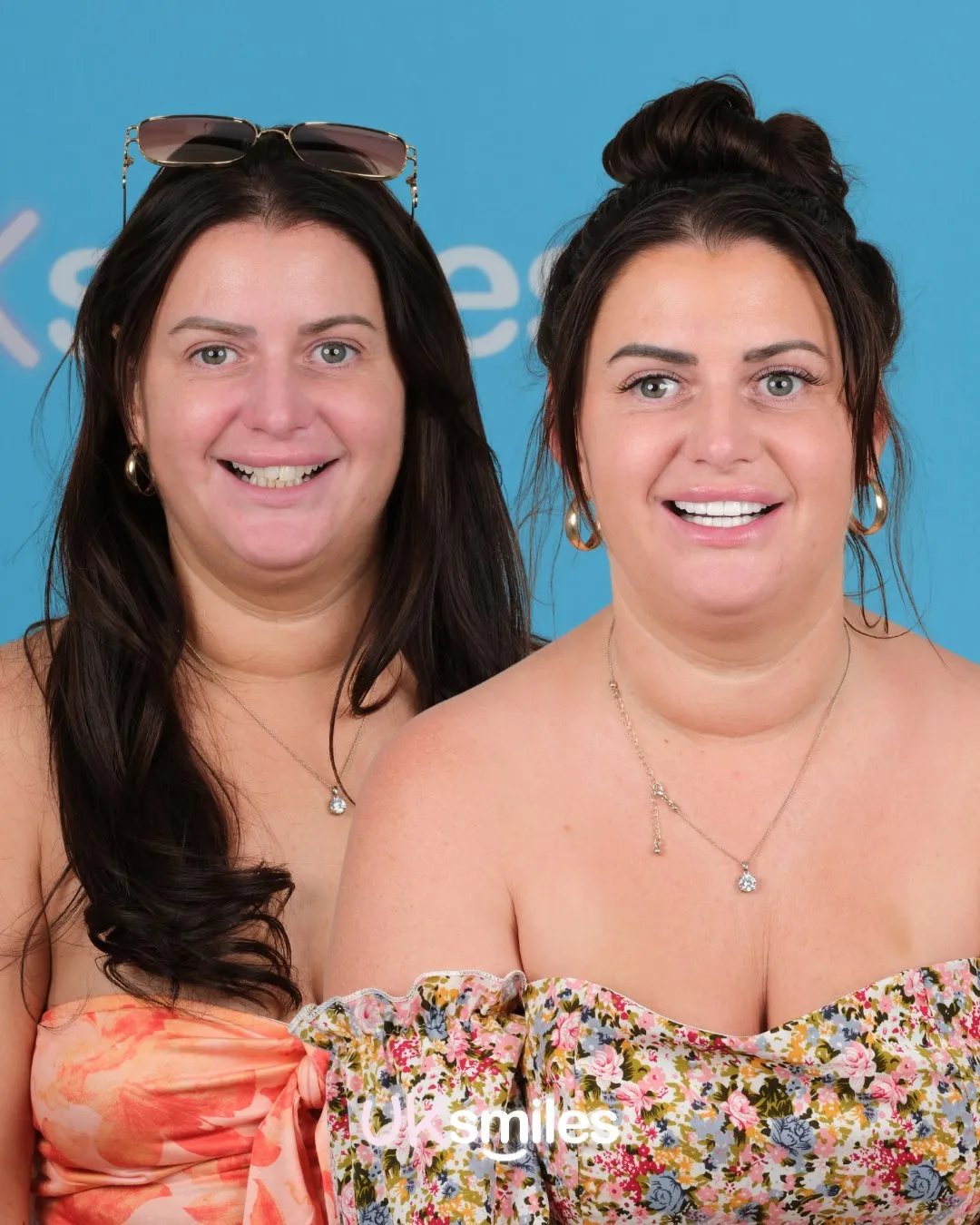 Woman in a floral top before and after her new teeth at UK Smiles
