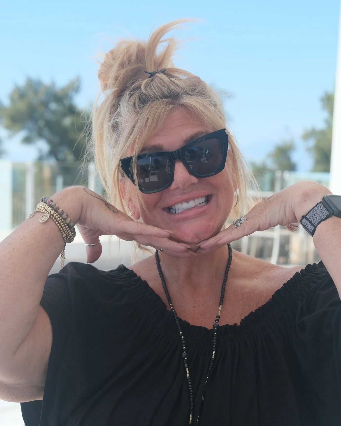 A UK Smiles patient showing off her new smile on a sunny hotel terrace in Antalya
