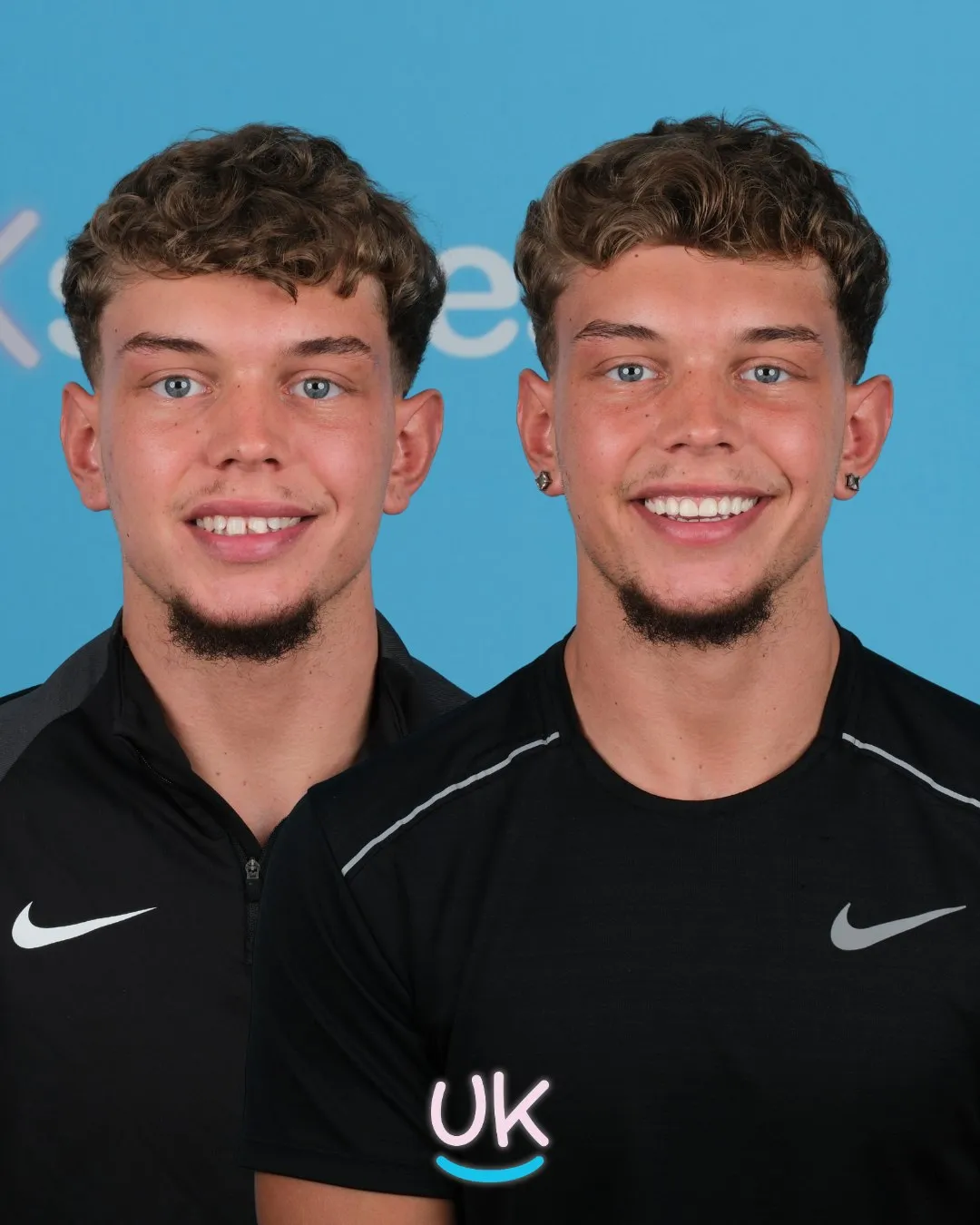 Young man in a black Nike top before and after his new smile