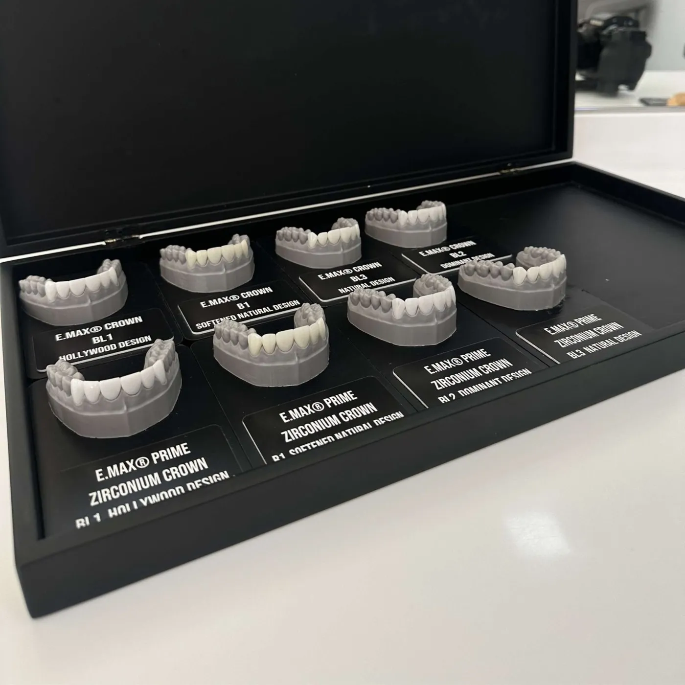 The UK Smiles design case, with Emax and zirconium crown models in Hollywood, dominant, natural and softened natural designs