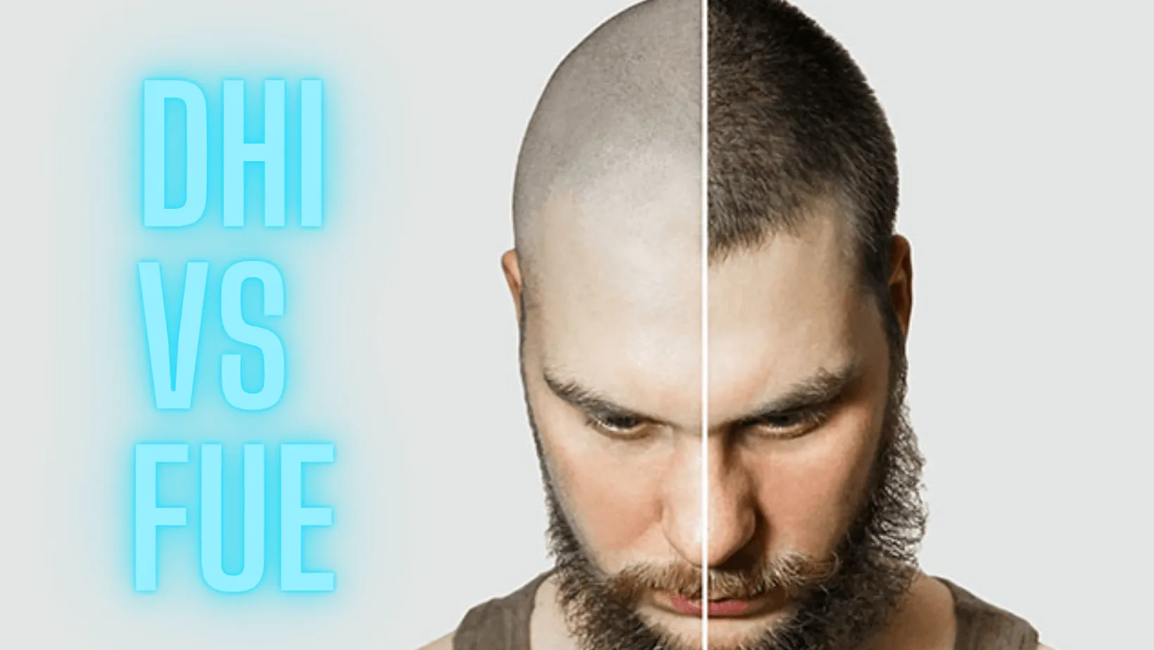 dhi vs FUe hair transplants