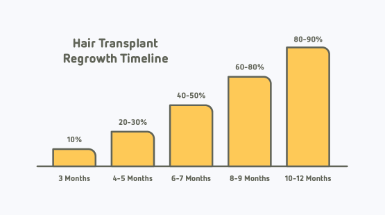 hair transplant success rates