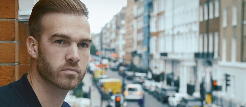 man who has had a hair transplant